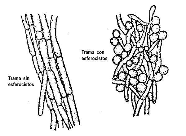 esferocitos al microscopio